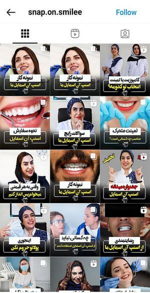 اسنپ آن اسمایل